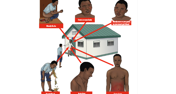 ebola fever signs and symptoms